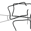 Aseptic Discitis with Instability after Posterior Spine Surgery