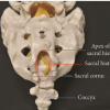 Caudal Epidural Steroid Injection in adults with Chronic Lower Backache: Comparison of Landmark-Guided Technique and Ultrasonography-Guided Technique