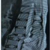 Spinal Aneurysmal Bone Cyst in a Pregnant Patient Presenting with Neurological Symptoms: A Case Report