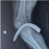 Double Whammy: Rare in-Tandem Impalement Injuries to Ipsilateral Knee and Ankle in a Rural Farmer – A Case Report