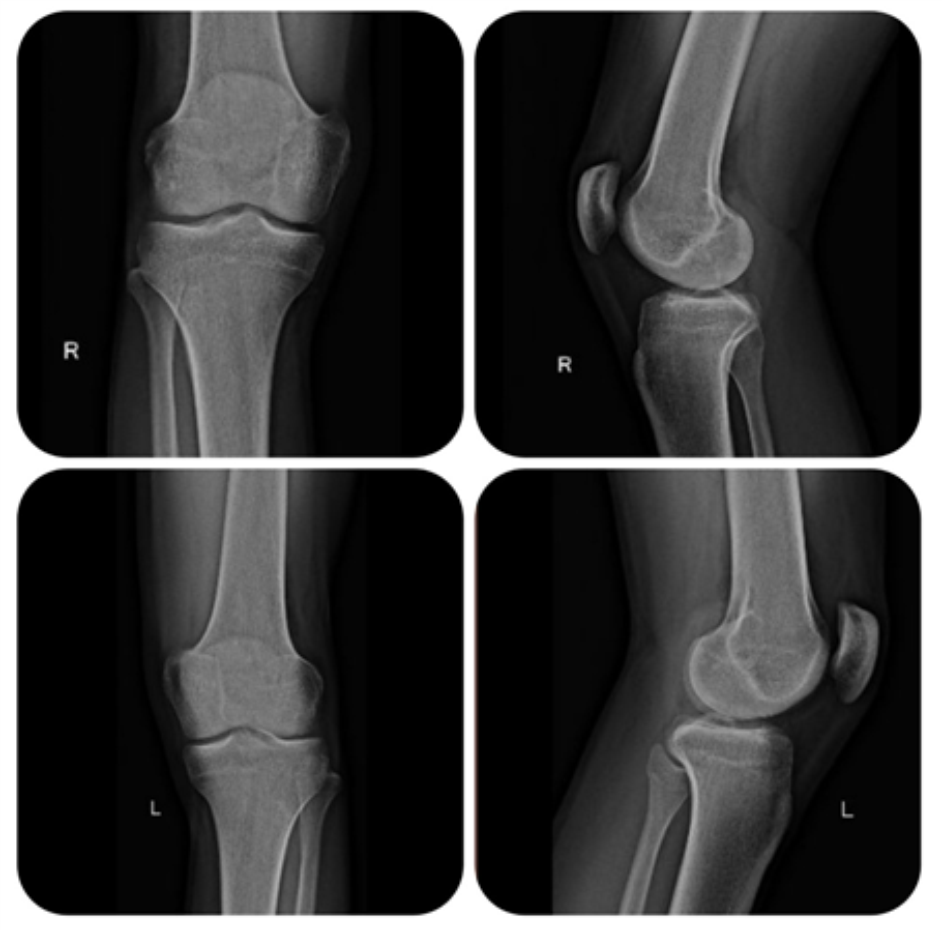 Featured Journal Of Orthopaedic Case Reports