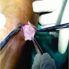 Ganglion Cyst of Knee from Hoffa’s Fat Pad Protruding Anterolaterally Through Retinacular Rent: A Case Report