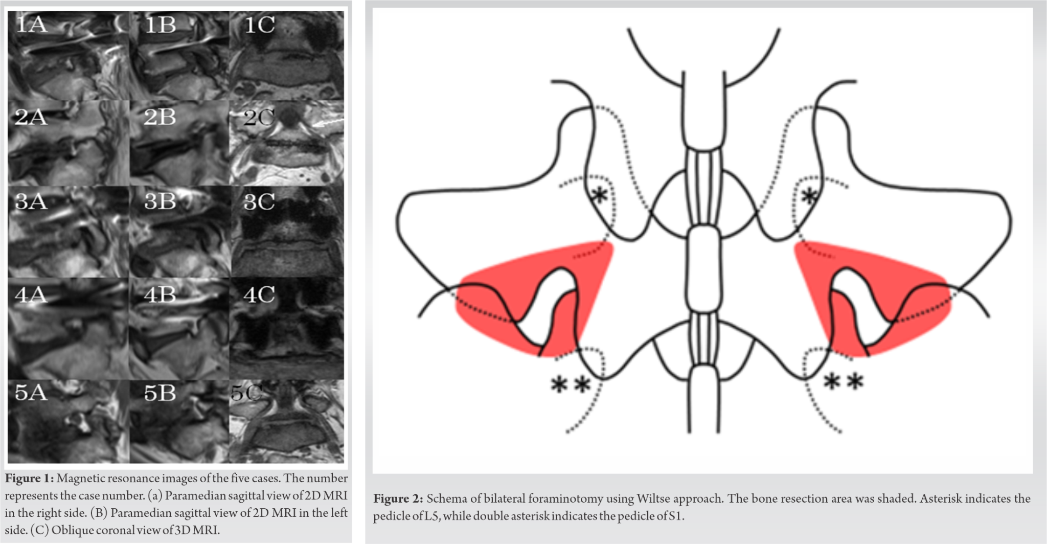 Fig 1 2 Journal Of Orthopaedic Case Reports fig-1-2-journal-of-orthopaedic-case-reports