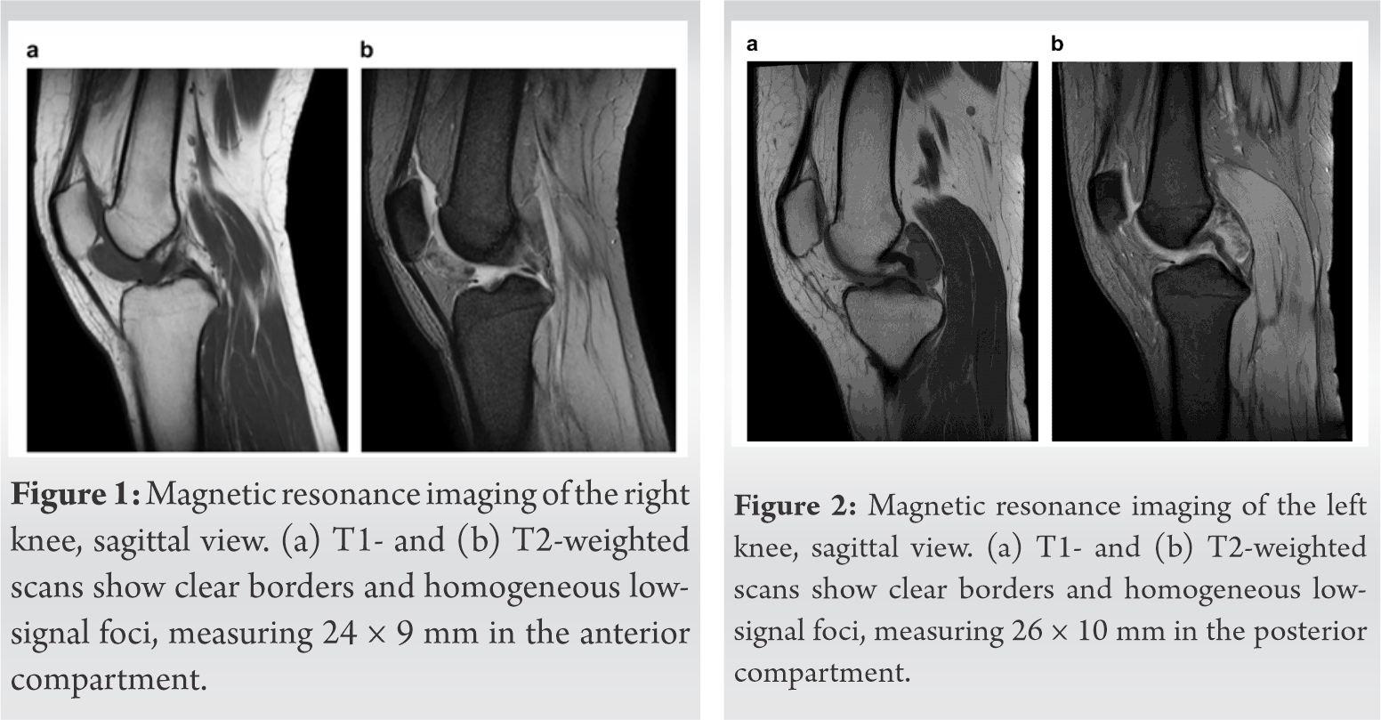 Fig 1 2 | Journal of Orthopaedic Case Reports