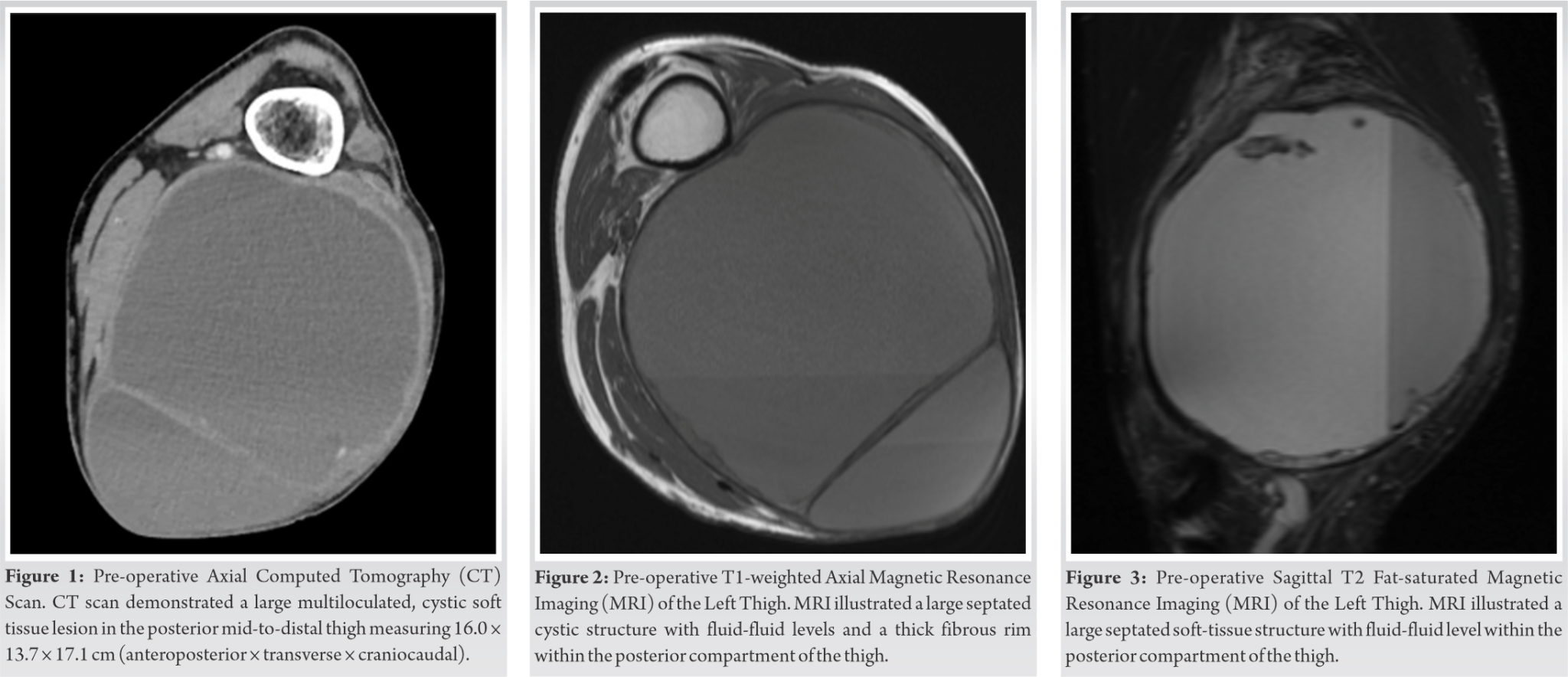 Fig 1 2 3 Fig 1 2 3