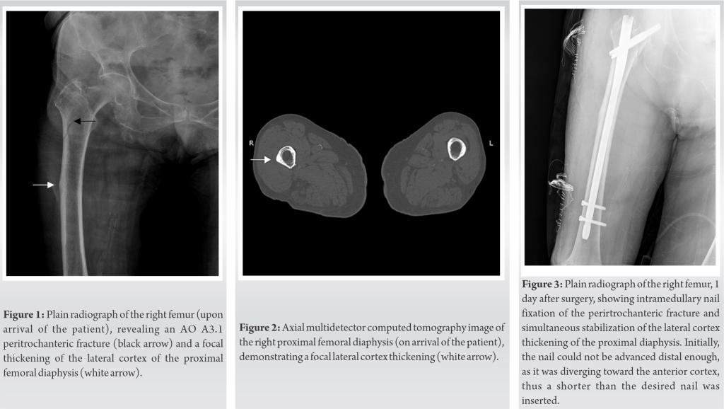 Fig 1 2 3 Journal Of Orthopaedic Case Reports fig-1-2-3-journal-of-orthopaedic-case-reports