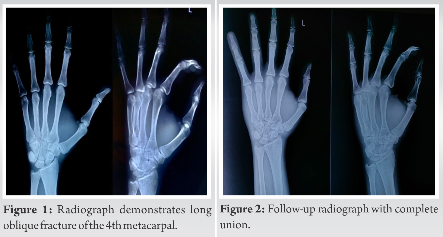 unusual-mechanism-of-injury-during-a-wedding-tradition-leading-to-a