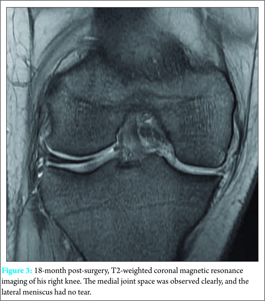 Fig 3 | Journal of Orthopaedic Case Reports