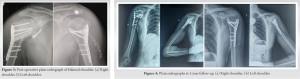 Fig 3 4