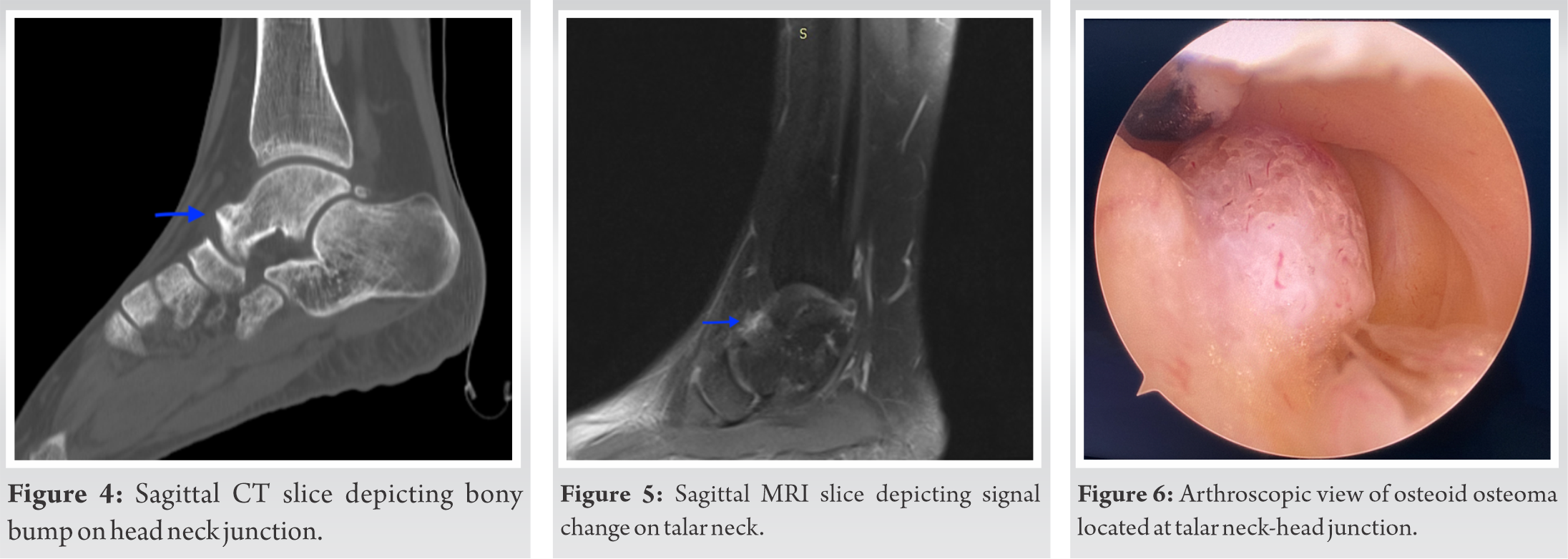 Fig 4 5 6 | Journal of Orthopaedic Case Reports