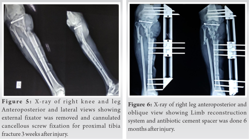 fig-5-6-journal-of-orthopaedic-case-reports