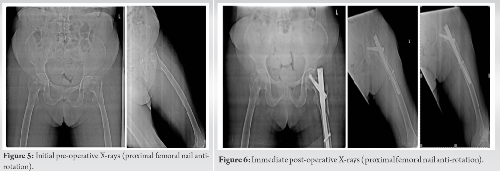Comparison of functional and radiological outcome of unstable ...