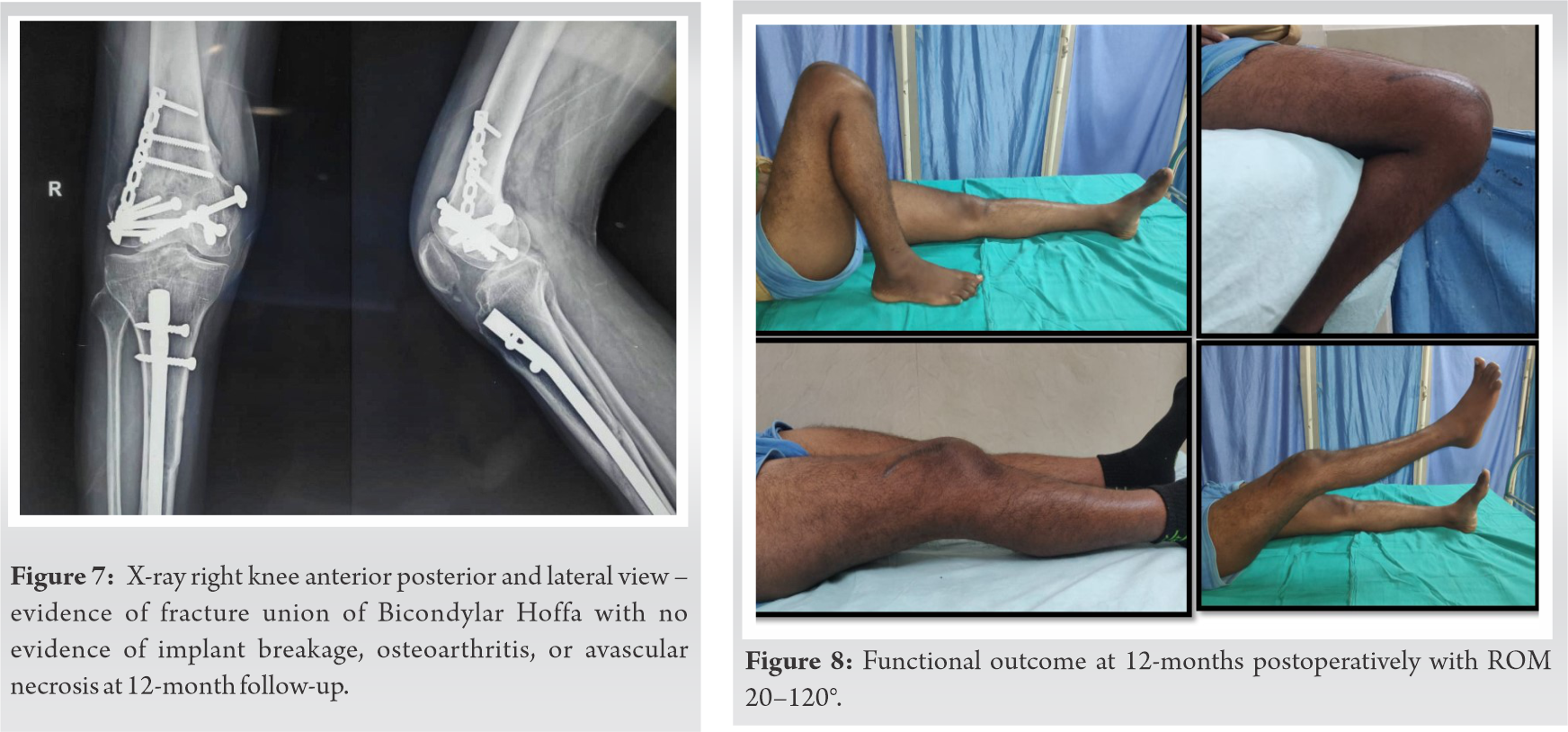 fig-7-8-journal-of-orthopaedic-case-reports