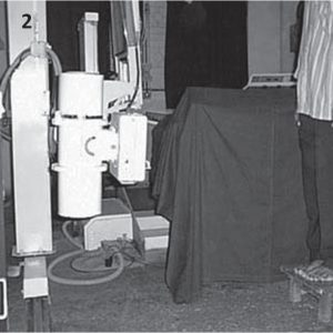 Figure 2 : Position of the wooden frame, patient and x-ray tube during full-length radiography.