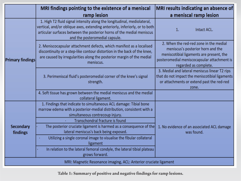 A Case Report on the Hidden Lesion of the Knee: Ramp Lesion | Journal ...