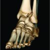 A Rare Cooccurrence of Tillaux-Chaput and Volkmann Fracture in an Adolescent Male: A Case Report